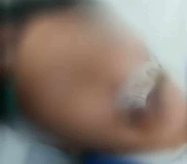 LES QUEMAN LA BOCA POR NO PAGAR UN CUARTO DE POLLO AL CARBÓN